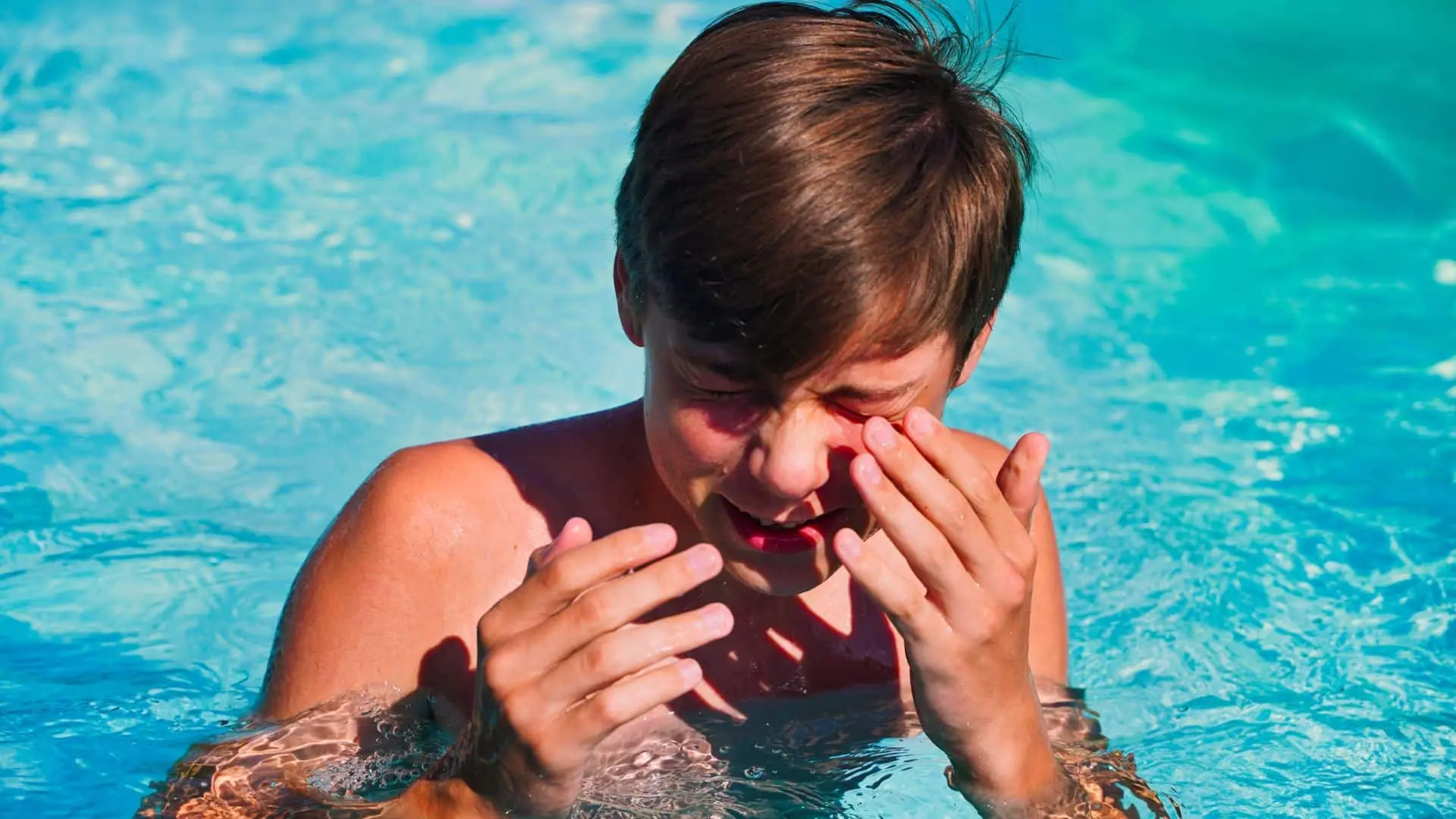 Chloramine trong hồ bơi gây kích ứng mắt và da